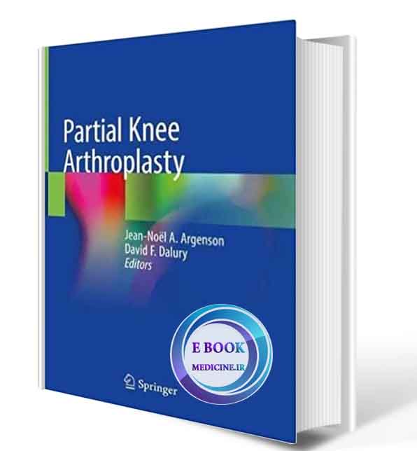 دانلود کتاب Partial Knee Arthroplasty 1st ed. 2019 ( PDF)